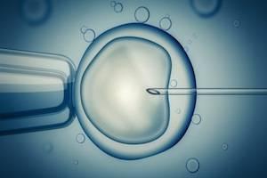 DuPage County parentage attorneys, assisted reproductive technology